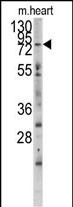 MLCK Antibody in Western Blot (WB)