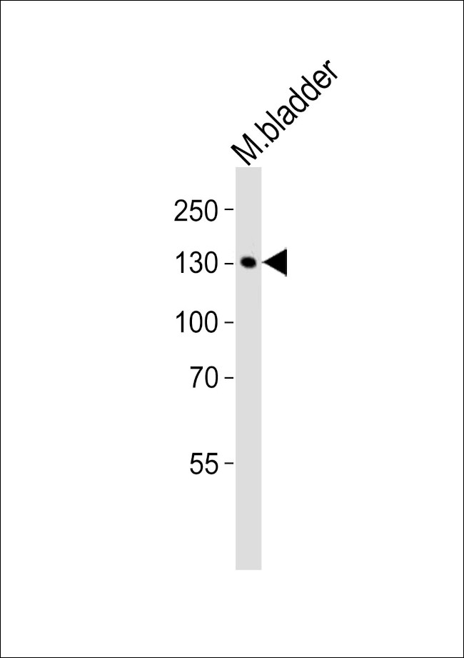 MYLK Antibody in Western Blot (WB)