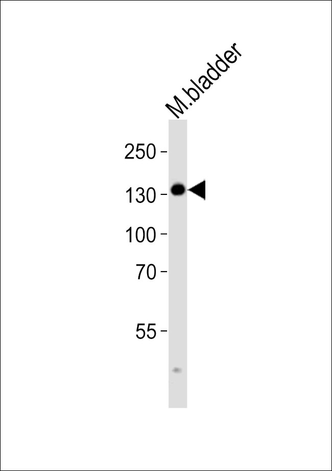 MYLK Antibody in Western Blot (WB)