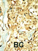 TNIK Antibody in Immunohistochemistry (Paraffin) (IHC (P))