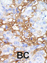 HPK1 Antibody in Immunohistochemistry (Paraffin) (IHC (P))