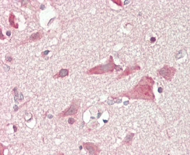 FGF10 Antibody in Immunohistochemistry (Paraffin) (IHC (P))