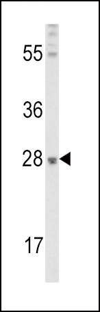 FGF10 Antibody in Western Blot (WB)