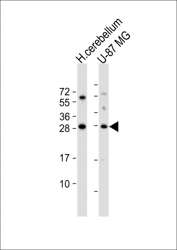 BDNF Antibody in Western Blot (WB)