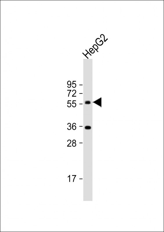 CYP7A1 Antibody in Western Blot (WB)