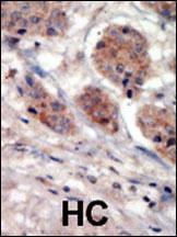 PI4K2A Antibody in Immunohistochemistry (Paraffin) (IHC (P))