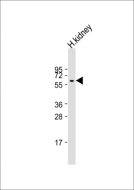 PI4K2A Antibody in Western Blot (WB)