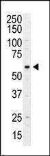 PI4K2A Antibody in Western Blot (WB)