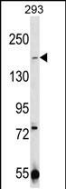 TRPM7 Antibody in Western Blot (WB)