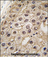 PERK Antibody in Immunohistochemistry (Paraffin) (IHC (P))