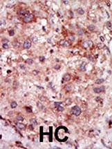 GAK Antibody in Immunohistochemistry (Paraffin) (IHC (P))