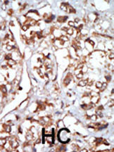 HRI Antibody in Immunohistochemistry (Paraffin) (IHC (P))