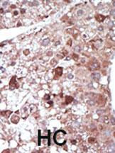 PCK1 Antibody in Immunohistochemistry (Paraffin) (IHC (P))