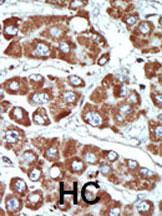 SIK1 Antibody in Immunohistochemistry (Paraffin) (IHC (P))