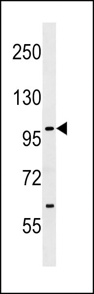 SIK1 Antibody in Western Blot (WB)