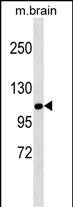 SIK1 Antibody in Western Blot (WB)