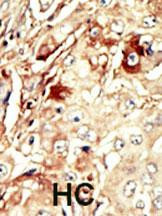 WEE1 Antibody in Immunohistochemistry (Paraffin) (IHC (P))