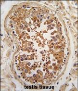 ULK3 Antibody in Immunohistochemistry (Paraffin) (IHC (P))