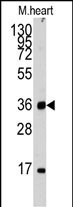 ULK3 Antibody in Western Blot (WB)