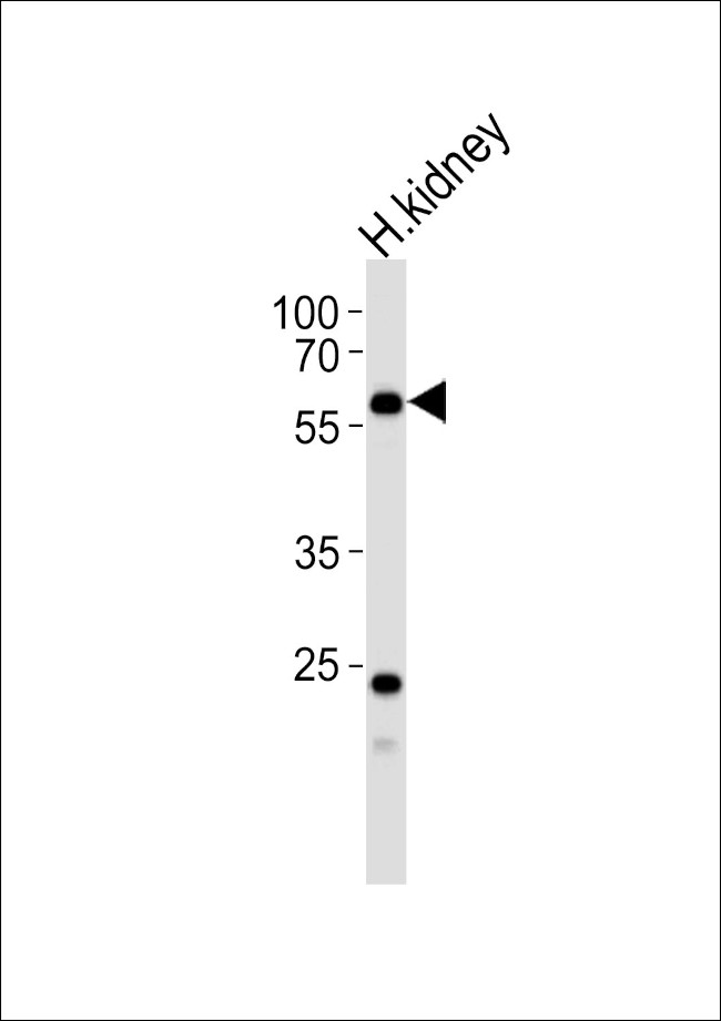 PFKFB3 Antibody in Western Blot (WB)