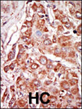 PKR Antibody in Immunohistochemistry (Paraffin) (IHC (P))