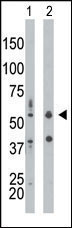 PKR Antibody in Western Blot (WB)