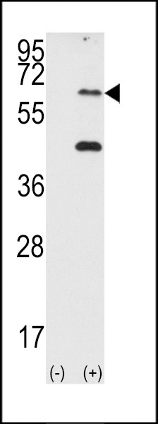 PKR Antibody in Western Blot (WB)