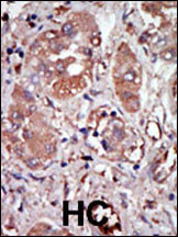 PKR Antibody in Immunohistochemistry (Paraffin) (IHC (P))