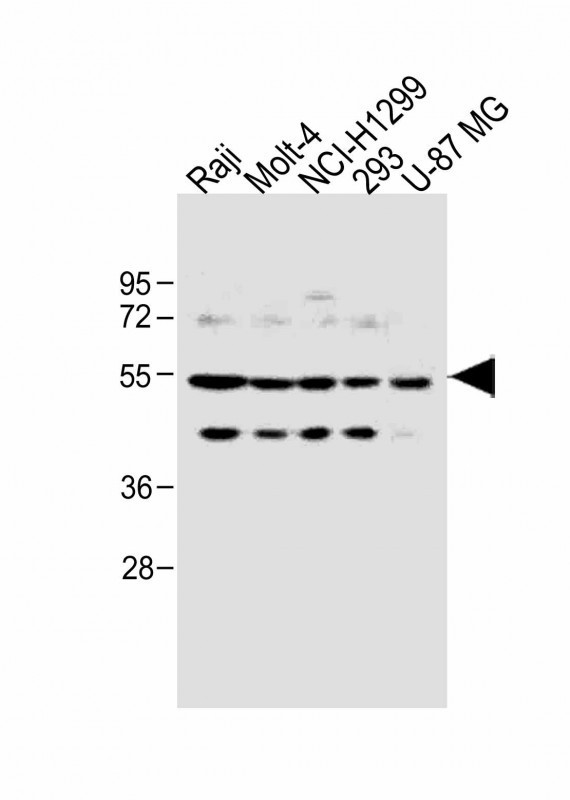 PFKFB4 Antibody in Western Blot (WB)