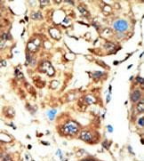 MAGI1 Antibody in Immunohistochemistry (Paraffin) (IHC (P))