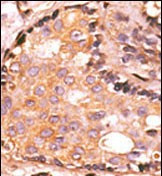 MKP2 Antibody in Immunohistochemistry (Paraffin) (IHC (P))