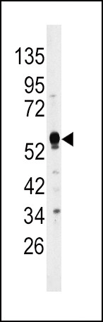 MKP2 Antibody in Western Blot (WB)