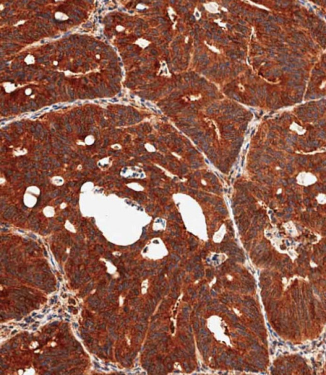 MKP3 Antibody in Immunohistochemistry (Paraffin) (IHC (P))