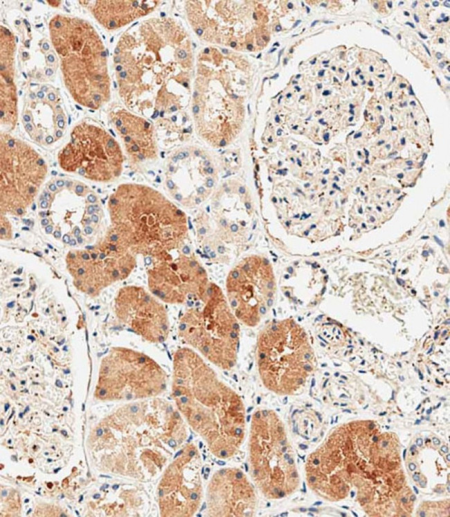 MKP3 Antibody in Immunohistochemistry (Paraffin) (IHC (P))