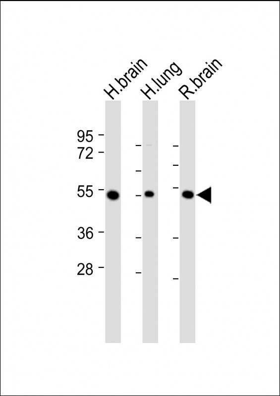 MKP3 Antibody in Western Blot (WB)