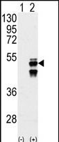 PPM1F Antibody in Western Blot (WB)