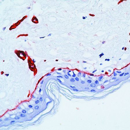 Laminin Antibody in Immunohistochemistry (IHC)