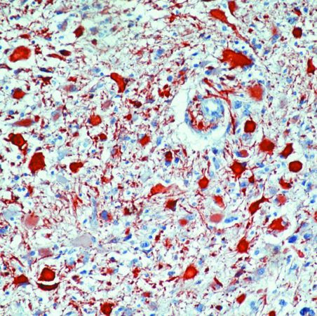 GFAP Antibody in Immunohistochemistry (Paraffin) (IHC (P))