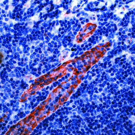 CD31 Antibody in Immunohistochemistry (Paraffin) (IHC (P))