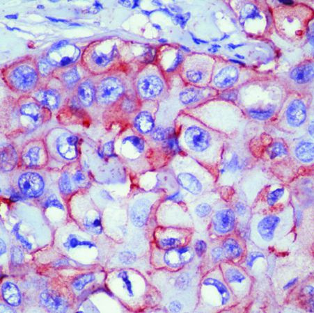 ErbB2 (HER-2) Antibody in Immunohistochemistry (Paraffin) (IHC (P))