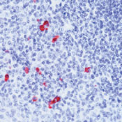 Human IgA (Heavy chain) Secondary Antibody in Immunohistochemistry (Paraffin) (IHC (P))