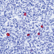 Human IgD (Heavy chain) Secondary Antibody in Immunohistochemistry (Paraffin) (IHC (P))