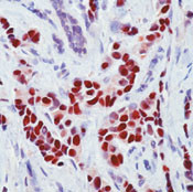 Estrogen Receptor alpha Antibody in Immunohistochemistry (Paraffin) (IHC (P))