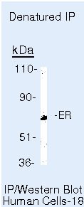 Estrogen Receptor alpha Antibody in Immunoprecipitation (IP)