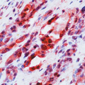 VEGF Receptor 2 Antibody in Immunohistochemistry (Paraffin) (IHC (P))