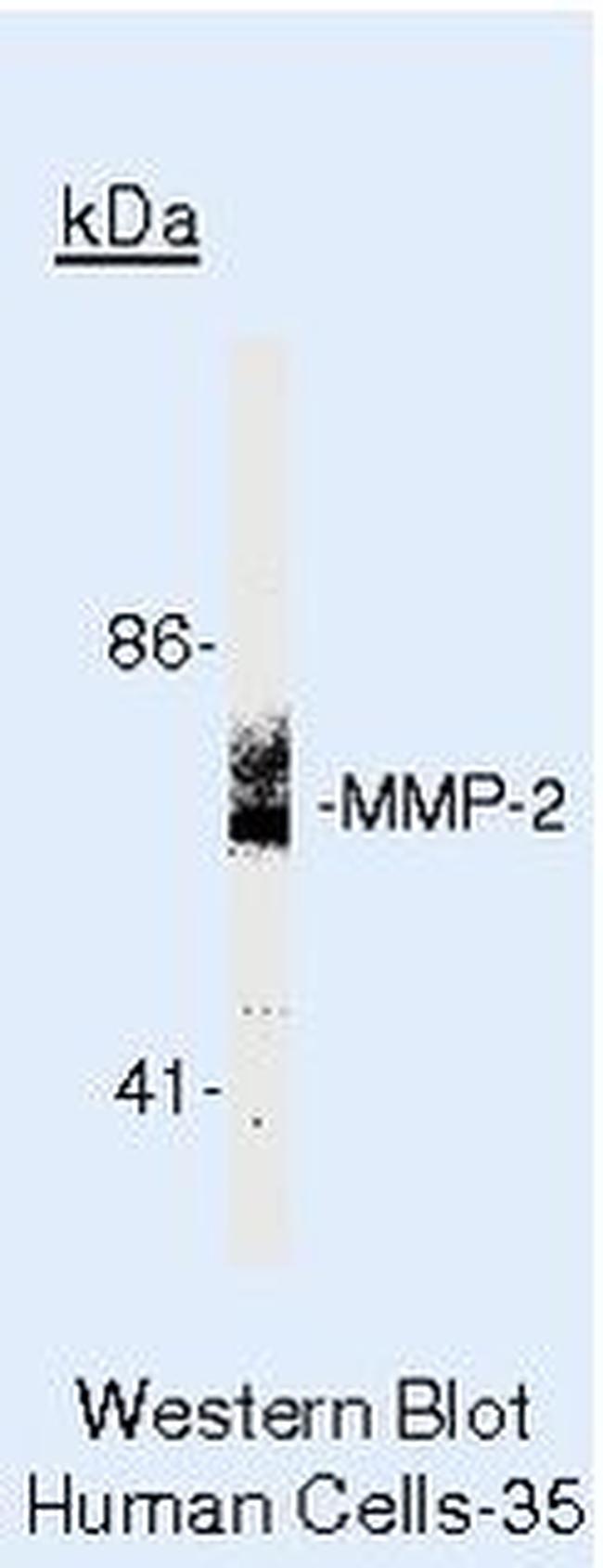 MMP2 Antibody in Western Blot (WB)