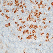 Kappa Light Chain Antibody in Immunohistochemistry (Paraffin) (IHC (P))