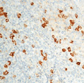 Lambda Light Chain Antibody in Immunohistochemistry (Paraffin) (IHC (P))