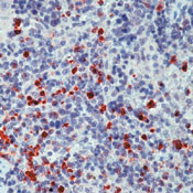 Myeloperoxidase Antibody in Immunohistochemistry (Paraffin) (IHC (P))