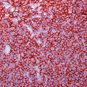 CD20 Antibody in Immunohistochemistry (Paraffin) (IHC (P))